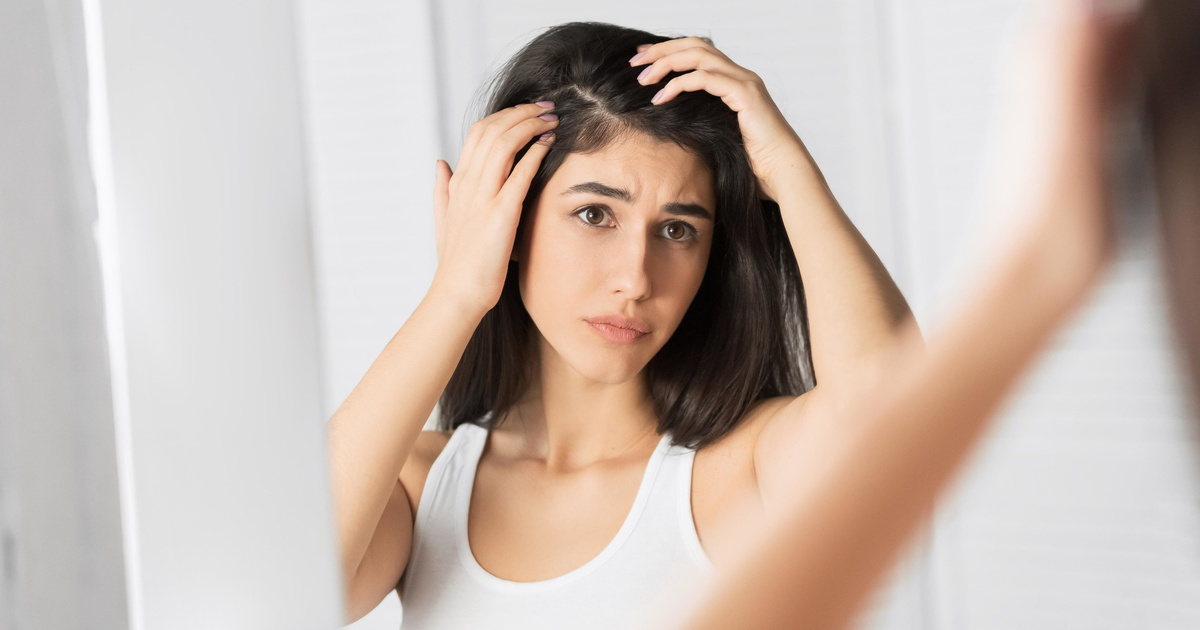 Effective Hair Loss Treatments for Women in the USA Effective Hair Loss Treatments for Women in the USA